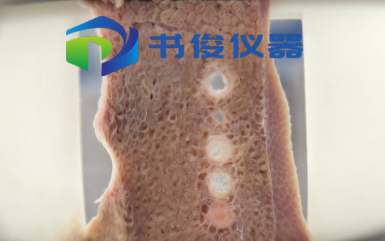 Histotripsy 组织摧毁术/空化机械消融应用方案
