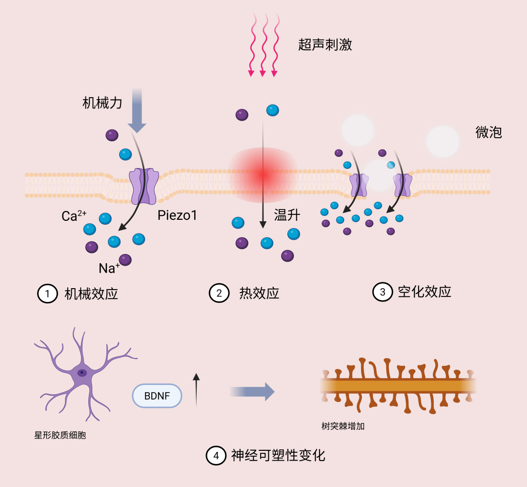 经颅聚焦超声：新型神经调控技术