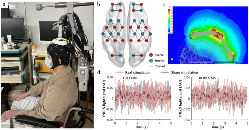 香港理工大学:实时fNIRS揭示低频/高频rTMS在卒中康复中的“差异化神经重塑机制”